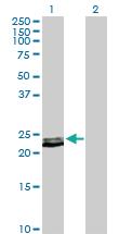 Anti-PRL Rabbit Polyclonal Antibody