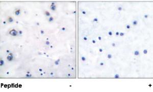 Anti-NTRK2 Rabbit Polyclonal Antibody