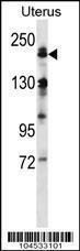 Anti-MAP3K4 Rabbit Polyclonal Antibody (Biotin)