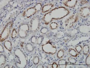 Anti-DLD Mouse Monoclonal Antibody [clone: 2D4]