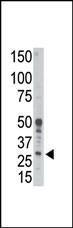 Anti-BCL2A1 Rabbit Polyclonal Antibody