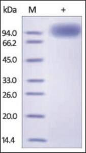 The purity of rh NTRK2 Fc Chimera was determined by DTT-reduced (+) SDS-PAGE and staining overnight with Coomassie Blue.