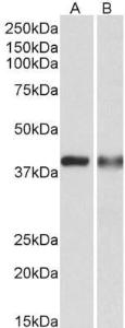 Anti-CAPG Antibody (A82918) (0.3 µg/ml) staining of U937 (A) and Human Spleen (B) lysates (35 µg protein in RIPA buffer). Primary incubation was 1 hour. Detected by chemiluminescence