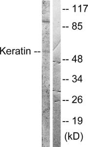 Western blot analysis of lysates from HeLa cells, treated with Anisomycin 25ug/ml 30' using Anti-Keratin 8 Antibody. The right hand lane represents a negative control, where the antibody is blocked by the immunising peptide