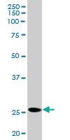 Anti-PRL Rabbit Polyclonal Antibody