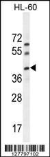 Anti-C17orf59 Rabbit Polyclonal Antibody (Biotin)