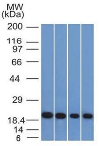 Western blot analysis of A431, HeLa, liver, and testis lysates using Anti-Ferritin Light Chain Antibody [FTL/1386]