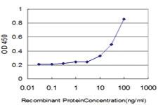 Anti-DLD Mouse Monoclonal Antibody [clone: 2D4]