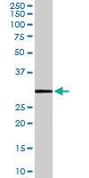 Anti-MMP7 Goat Polyclonal Antibody