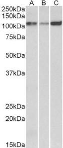 Anti-ATP2A2 Antibody (A82919) (0.1 µg/ml) staining of Human (A), Mouse (B) and Rat (C) Heart lysates (35 µg protein in RIPA buffer). Primary incubation was 1 hour. Detected by chemiluminescence