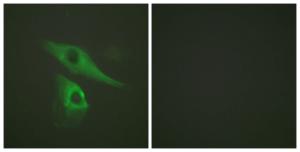 Immunofluorescence analysis of HeLa cells using Anti-Keratin 8 Antibody. The right hand panel represents a negative control, where the antibody was pre-incubated with the immunising peptide