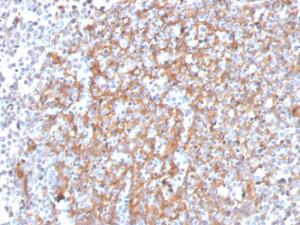 Immunohistochemical analysis of formalin-fixed, paraffin-embedded human prostate using Anti-Cystatin A Antibody [CSTA/3553]