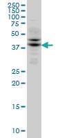 Anti-TRIB2 Mouse Monoclonal Antibody [clone: 1B1]