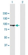 Anti-DLG3 Mouse Polyclonal Antibody