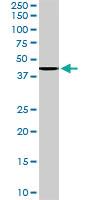 Anti-ERLIN2 Goat Polyclonal Antibody