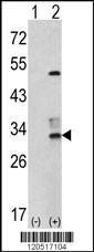 Anti-CAPZB Rabbit Polyclonal Antibody (APC (Allophycocyanin))