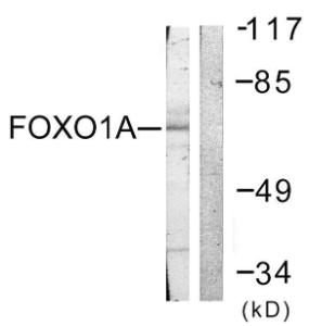 Western blot analysis of lysates from HeLa cells, treated with Serum 20% 15' using Anti-FOXO1A Antibody. The right hand lane represents a negative control, where the antibody is blocked by the immunising peptide.