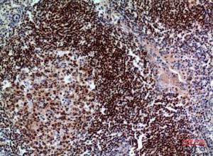 Immunohistochemical analysis of paraffin-embedded human tonsil using Anti-PAX5 Antibody