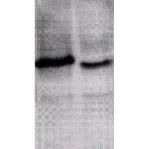 Western blot analysis of mouse brain cell lysates showing detection of ING1 protein using Anti-ING1 Antibody (A304909) at 1:1,000. Left: cell expressed flag-tag. Right: Untagged