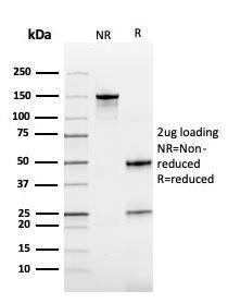 SDS-PAGE analysis of Anti-Cystatin B Antibody [CPTC-CSTB-3] under non-reduced and reduced conditions; showing intact IgG and intact heavy and light chains, respectively. SDS-PAGE analysis confirms the integrity and purity of the antibody.