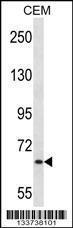 Anti-MEN1 Rabbit Polyclonal Antibody (FITC (Fluorescein Isothiocyanate))