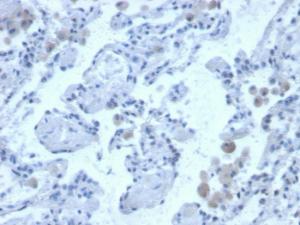 Immunohistochemical analysis of formalin-fixed, paraffin-embedded human lung using Anti-Cystatin B Antibody [CPTC-CSTB-3]