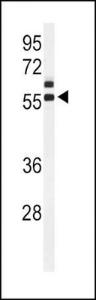 Anti-AMH Rabbit Polyclonal Antibody (HRP (Horseradish Peroxidase))