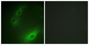 Immunofluorescence analysis of HUVEC cells using Anti-FOXO1A Antibody. The right hand panel represents a negative control, where the antibody was pre-incubated with the immunising peptide.