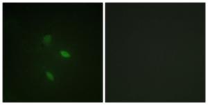 Immunofluorescence analysis of NIH/3T3 cells using Anti-Cyclin E2 Antibody. The right hand panel represents a negative control, where the antibody was pre-incubated with the immunising peptide