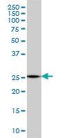 Anti-MTHFS Mouse Monoclonal Antibody [clone: 2C12]