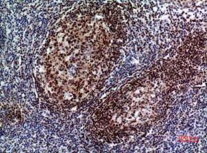 Immunohistochemical analysis of paraffin-embedded human tonsil using Anti-PAX5 Antibody