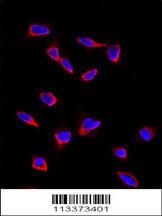 Anti-SOX9 Rabbit Polyclonal Antibody (FITC (Fluorescein Isothiocyanate))