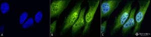 Immunocytochemistry/Immunofluorescence analysis of human heat shocked cervical cancer cell line (HeLa), fixed in 2% formaldehyde for 20 minutes at room temperature, using Anti-ING1 Antibody (A304909), at 1:50 for 12 hours at 4 °C