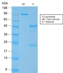 Anti-MYH11 Rabbit Recombinant Antibody [clone: MYH11/2303R]