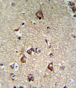 Anti-TFRC Rabbit Polyclonal Antibody