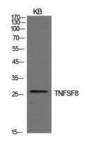 Western blot analysis of extracts from KB cells using Anti-TNFSF8 Antibody