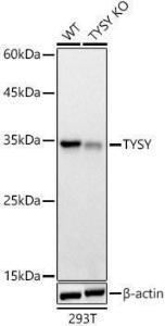 Anti-Thymidylate Synthase antibody