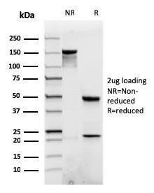 SDS-PAGE analysis of Anti-beta Catenin Antibody [rCTNNB1/1507] under non-reduced and reduced conditions; showing intact IgG and intact heavy and light chains, respectively. SDS-PAGE analysis confirms the integrity and purity of the antibody