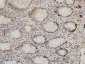 Anti-TRIB2 Mouse Monoclonal Antibody [clone: 1B1]