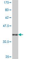 Anti-FBXO30 Mouse Polyclonal Antibody