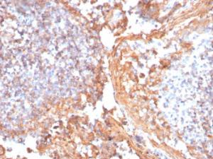 Immunohistochemical analysis of formalin-fixed, paraffin-embedded human tonsil using Anti-beta Catenin Antibody [rCTNNB1/1507]