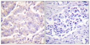 Anti-c-PLA2 antibody