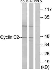 Western blot analysis of lysates from COLO and Jurkat cells using Anti-Cyclin E2 Antibody. The right hand lane represents a negative control, where the antibody is blocked by the immunising peptide