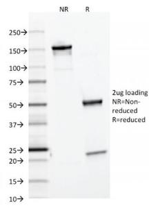 SDS-PAGE analysis of Anti-Ferritin Light Chain Antibody [FTL/1386] under non-reduced and reduced conditions; showing intact IgG and intact heavy and light chains, respectively. SDS-PAGE analysis confirms the integrity and purity of the antibody