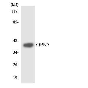 Western blot analysis of the lysates from HUVEC cells using Anti-OPN5 Antibody