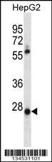 Anti-MEOX1 Rabbit Polyclonal Antibody (HRP (Horseradish Peroxidase))