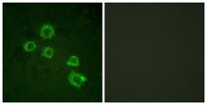 Anti-c-PLA2 antibody