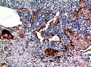 Immunohistochemical analysis of paraffin-embedded human lung using Anti-MUC1 Antibody