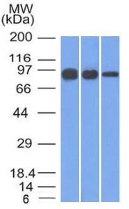 Western blot analysis of A431, A549, and MCF-7 cell lysates using Anti-beta Catenin Antibody [12F7]