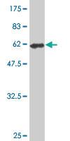 Anti-KDSR Mouse Monoclonal Antibody [clone: 2B2-3C11]